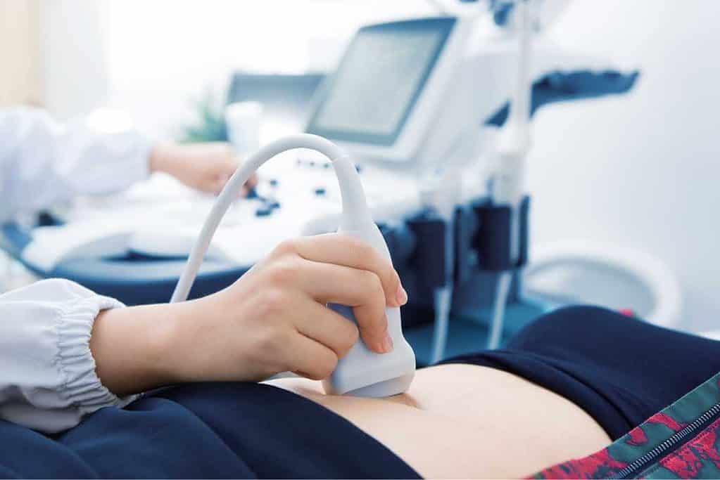 Echo apparaat leasen