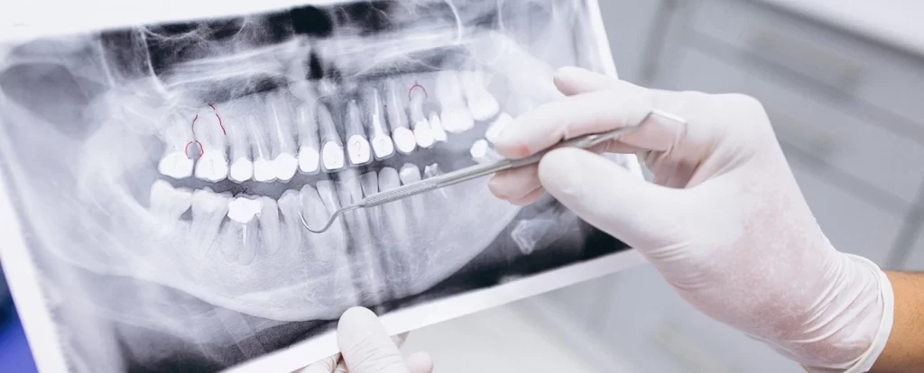 rontgen apparatuur leasen