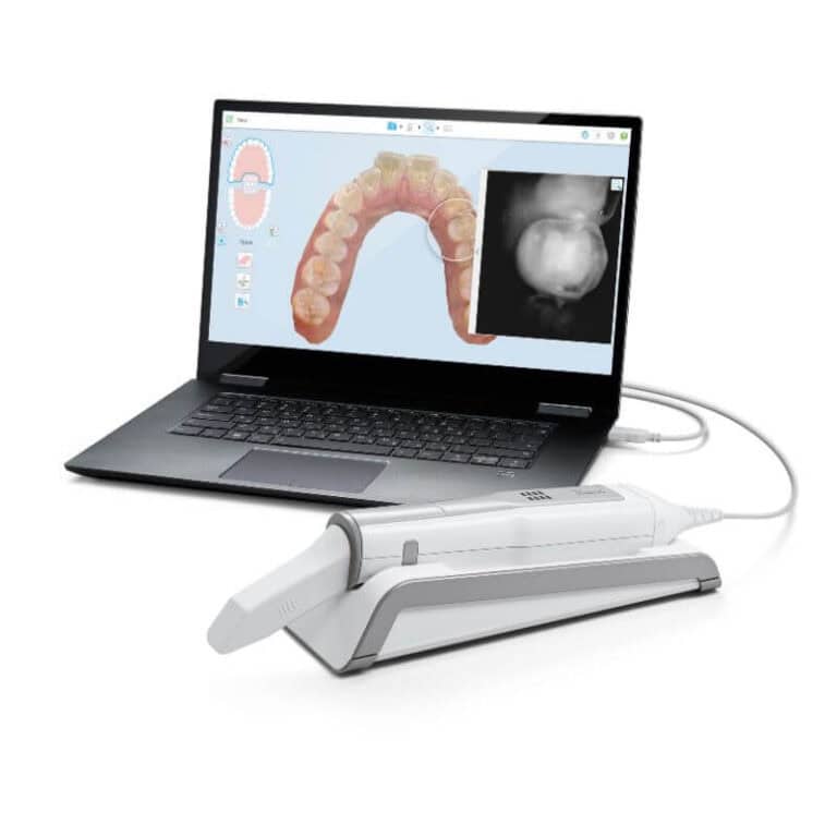 iTero Scanner 5D